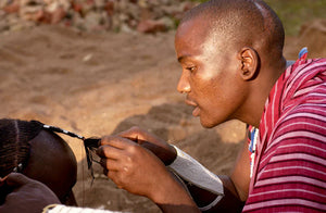 The Psychological Effects of Hair Loss on Self-Esteem